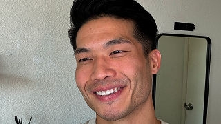 Botox Patient Stories - Andrew