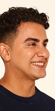 Botox forehead lines, frown lines, crow's feet lines after - Jeffrey