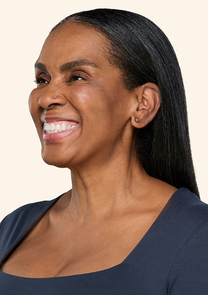 Botox neck and jaw after - Devonna
