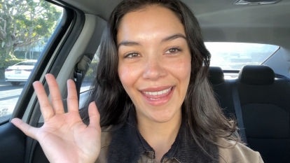 Botox Patient Stories - Vanessa