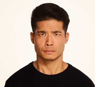 Botox frown lines before - Andrew