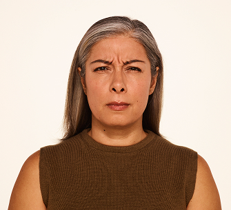 Botox frown lines before - Delfina