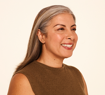 Botox crow's feet lines after - Delfina