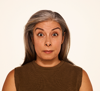 Botox forehead lines before - Delfina