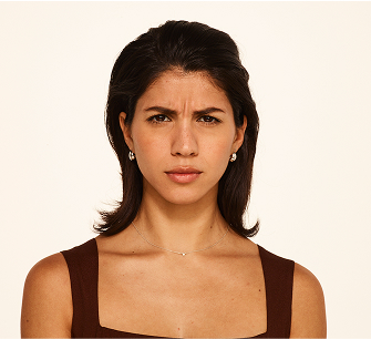 Botox frown lines before - nicole