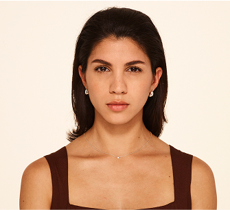 Botox frown lines after - nicole