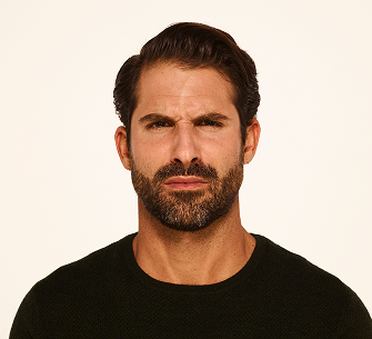 Botox frown lines before - Stephen
