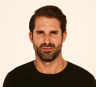 Botox frown lines after - Stephen